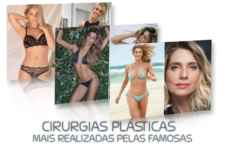 Confira As Cirurgias Pl Sticas Mais Realizadas Pelas Famosas Dra