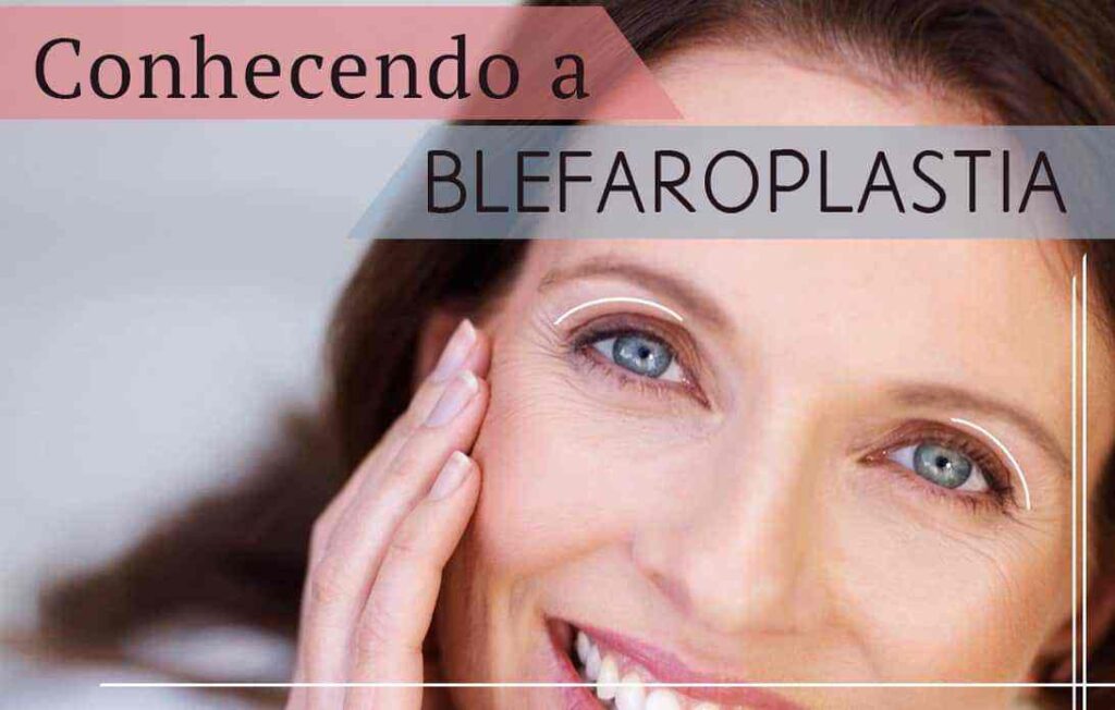 conhecendo-blefaroplastia