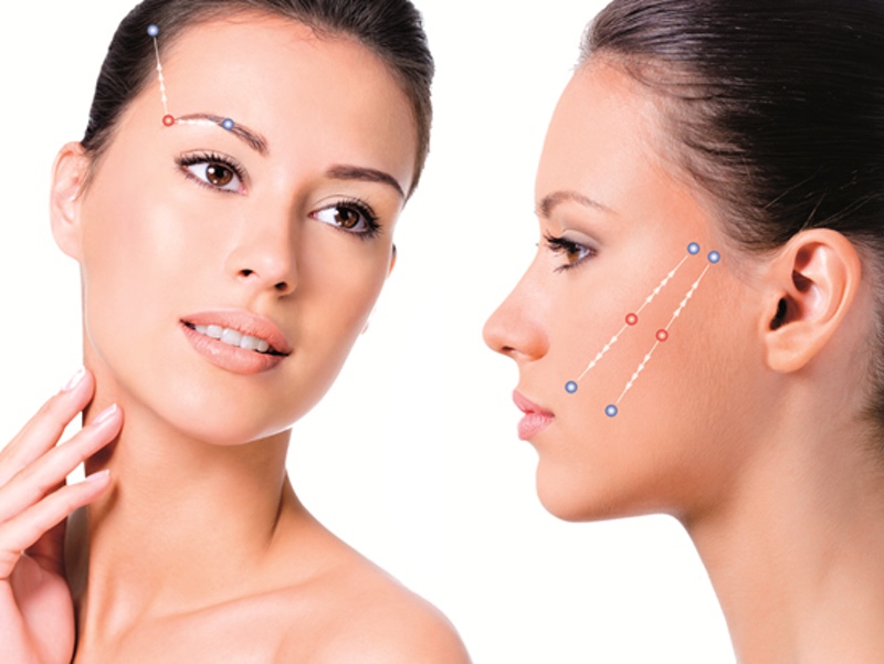 Como rejuvenescer a pele com os Fios de Sustentação Facial?