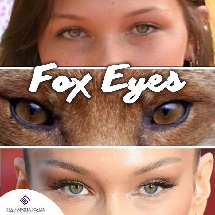 fox_eyes