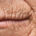 Envelhecimento Dos Labios Dra Marcela Scarpa Explica