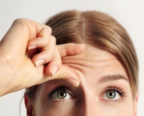 Botox Dura Pouco Dra Marcela Scarpa Explica