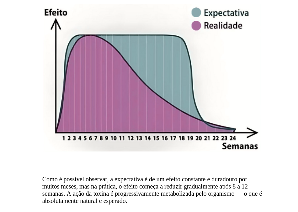 Grafico Duracao Do Botox Toxina Botulinica Dra Marcela Scarpa