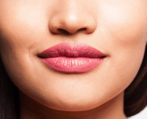 Instagram Afeta Desejo Por Preenchimento Labial Dura Pouco Dra Marcela Scarpa Explica.jpg