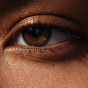 Blog Dra Marcela Scarpa Cirurgia Plastica E Saude Blefaroplastia 1