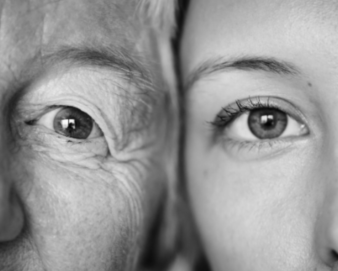 Blog Dra Marcela Scarpa Cirurgia Plastica E Saude Blefaroplastia Em Mulheres 34