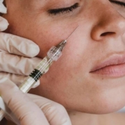 Blog Dra Marcela Scarpa Cirurgia Plastica E Saude Preenchimento Acido Hialuronico