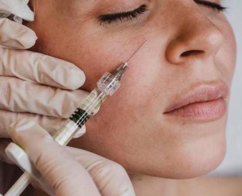 Blog Dra Marcela Scarpa Cirurgia Plastica E Saude Preenchimento Acido Hialuronico