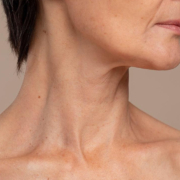 Site Blog Dra Marcela Scarpa Cirurgia Plastica Deep Neck A Cirurgia Que Redefine O Pescoc O E A Papada Tratamento Avancado Do Turkey Neck
