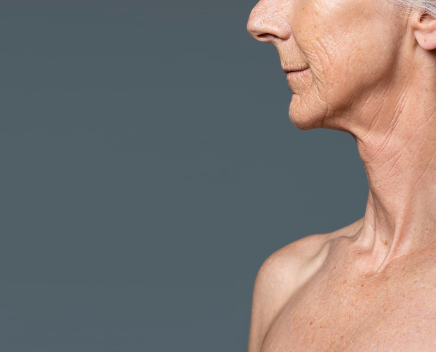 Site Blog Dra Marcela Scarpa Cirurgia Plastica Deep Neck A Cirurgia Que Redefine O Pescoc O E A Papada Tratamento Avancado Do Turkey Neck 2