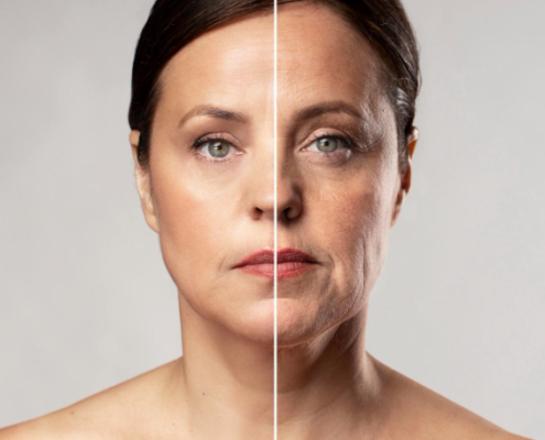 Lift Facial 1 Artigo Site Blog Dra Marcela Scarpa Cirurgia Plastica 2026 09 03 12 09 20