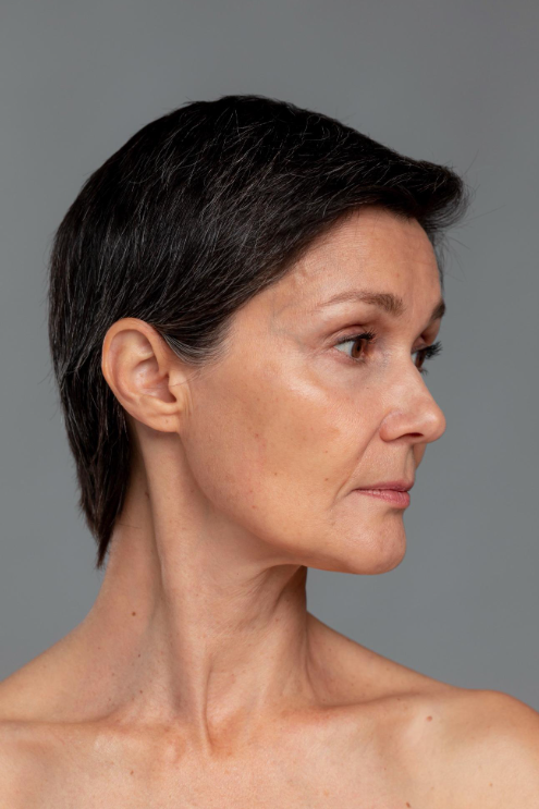 Procediemnto Facial Lipo Enxertia Facial Dra Marcela Scarpa Cirurgia Plastica